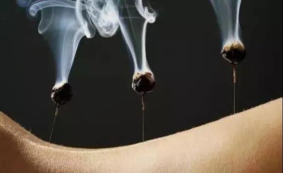 艾灸不是藥，調(diào)的不是病，央視為艾灸正名，讓我們正視艾灸